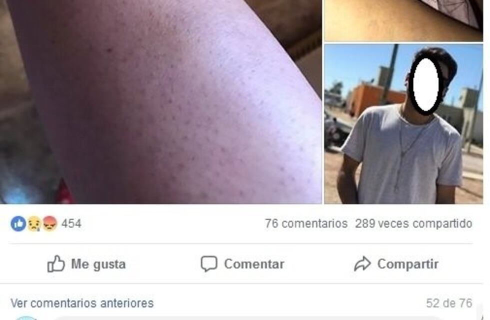 En un día, cuatro mujeres escracharon a sus parejas por violencia de género