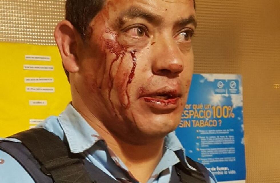 Dos motociclistas intentaron evadir un control y golpearon a un policía