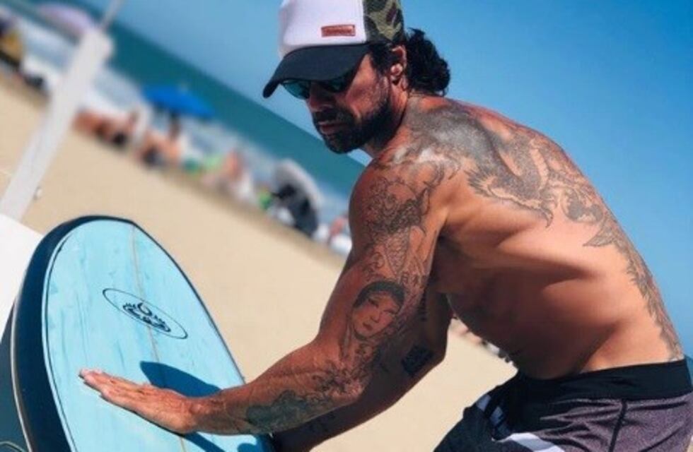 Luciano Castro sufrió un accidente haciendo surf: así le quedó el rostro