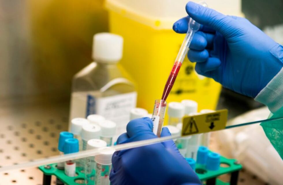 Hasta este viernes Salta registra 29 casos positivos de coronavirus