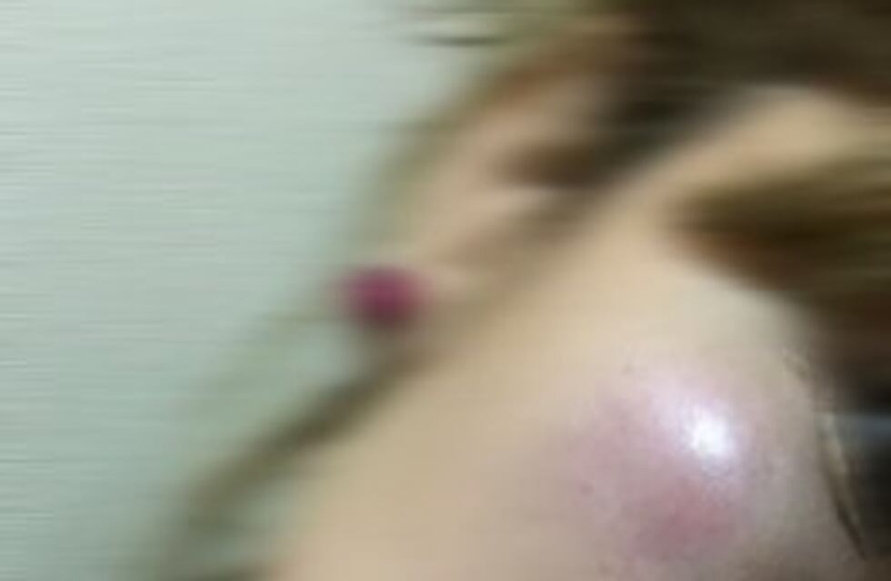 Salvaje agresión a una estudiante cuando salía del colegio