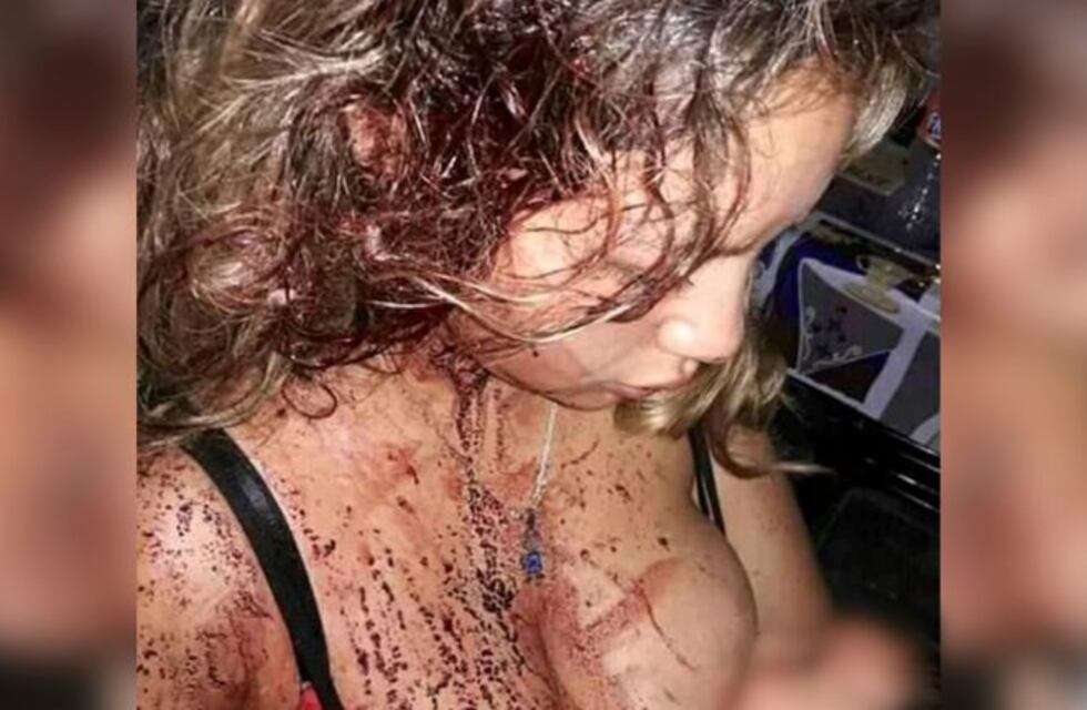 Bestial ataque a una joven madre en un barrio de Salta