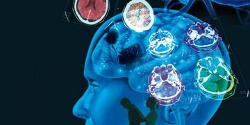 30 de mayo, día de la esclerosis múltiple