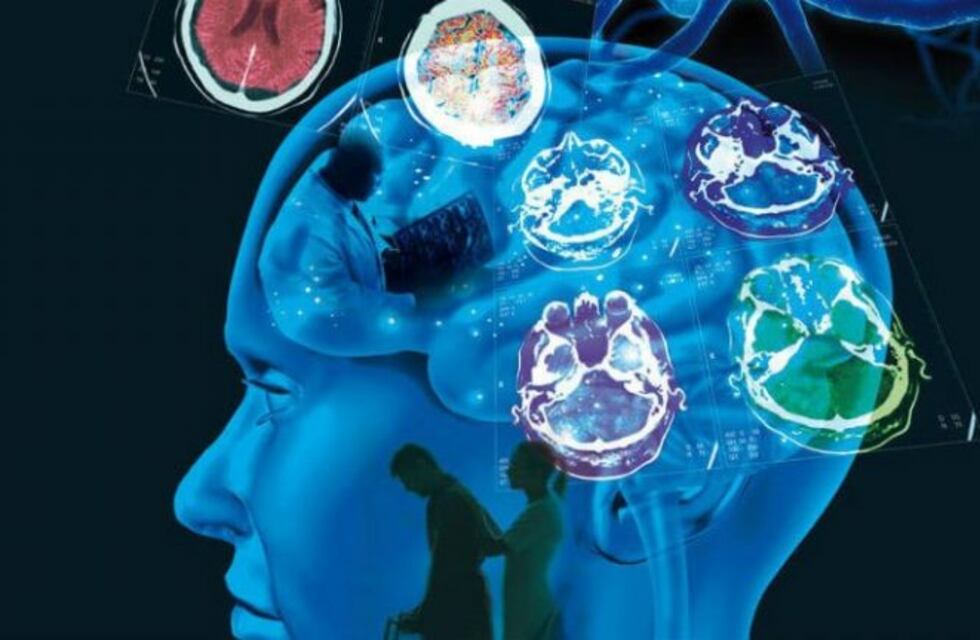 Esclerosis Múltiple: la causa de discapacidad más común en adultos jóvenes