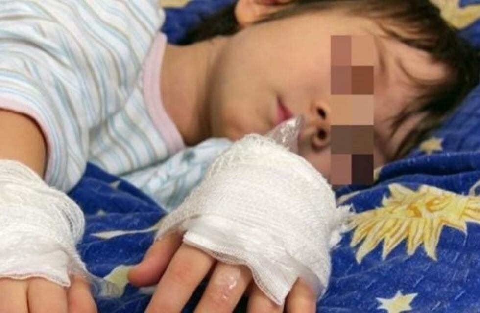 La mujer que le quemó las manos a su hijo como castigo, ante el juez