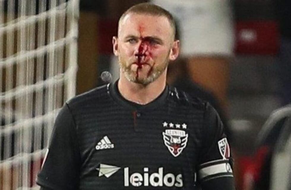 El sangriento partido de Wayne Rooney en la MLS