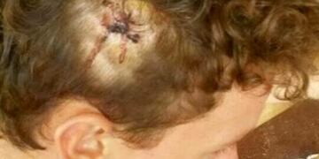 El hijo mayor de la familia terminó con una lesión en la cabeza tras el ataque\u002E