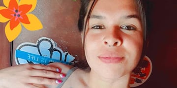 La muchacha sufrió múltiples heridas durante un ataque sobre Vilcapugio al 600.