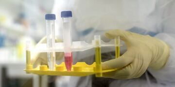 Dos casos de coronavirus en Tunuyán, Mendoza\u002E