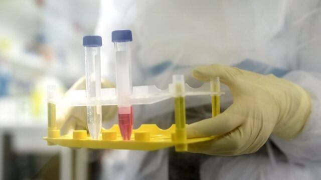 Coronavirus, Mendoza\u002E