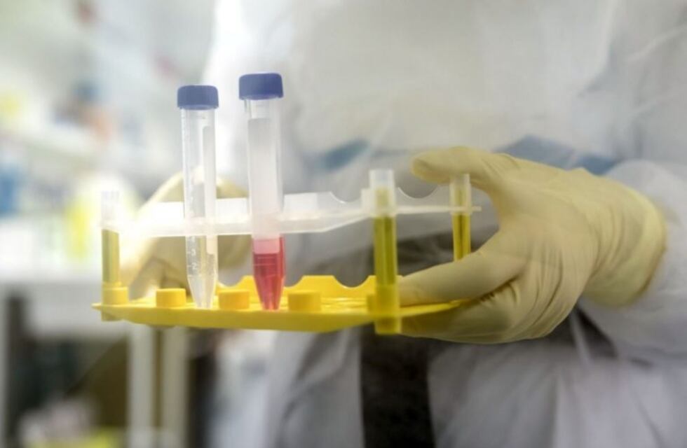 Covid-19: en Mendoza confirmaron 128 nuevos casos positivos y 4 fallecidos