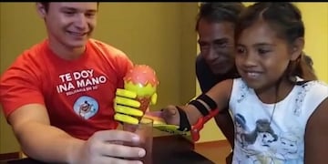 Lilian Ojeda recibió una mano ortopédica hecha con impresoras 3D de parte de la fundación \