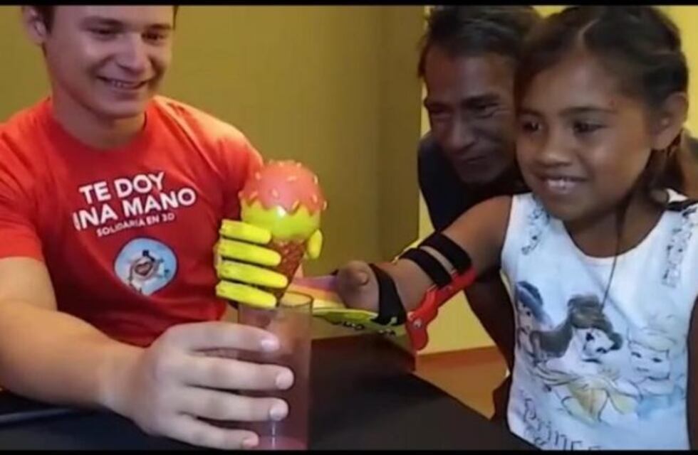 Donaron una mano ortopédica a una niña guaraní