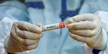 Confirmaron un caso nuevo de COVID-19 en San Luis