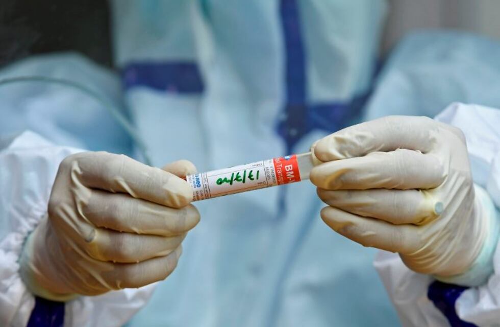 Confirmaron un caso nuevo de COVID-19 en San Luis