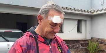 Vecino atacado por una patota en Río Cuarto