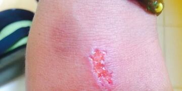 Preocupación por la reaparición del peligroso juego \