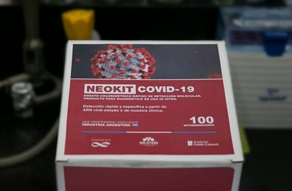 Así funciona el "Neokit-Covid-19", el nuevo test rápido creado por científicos argentinos