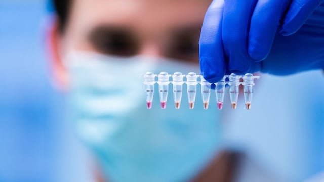 A man shows yellow coloured coronavirus Covid-19 positive samples, as Viennese research institutes and the Agency for Health and Food Security (AGES) present a new coronavirus Covid-19 test method called \