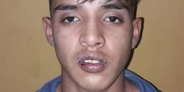 Golpeado y herido por reclamar su bicicleta robada\u002E