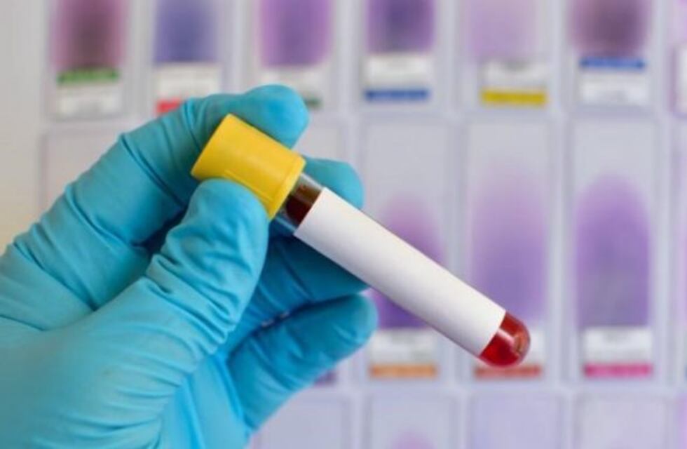 Coronavirus: hay 77 casos positivos en Tierra del Fuego, ya son 12 los que recibieron el alta