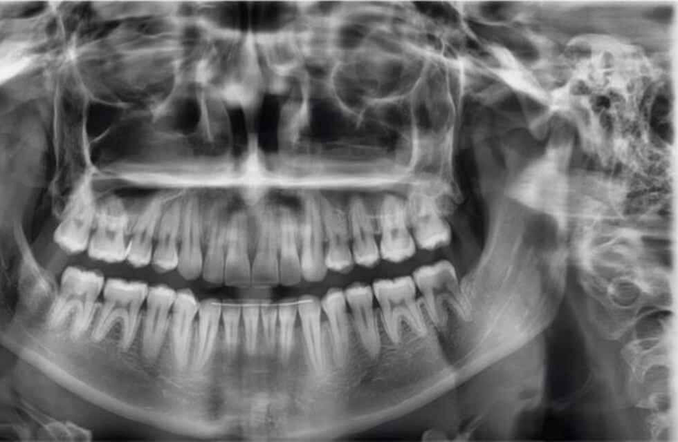 Centro de odontología ofrece novedoso servicio de radiografía