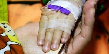 La mayoría de los casos son quemaduras superficiales y también se presentaron algunos trastornos auditivos\u002E