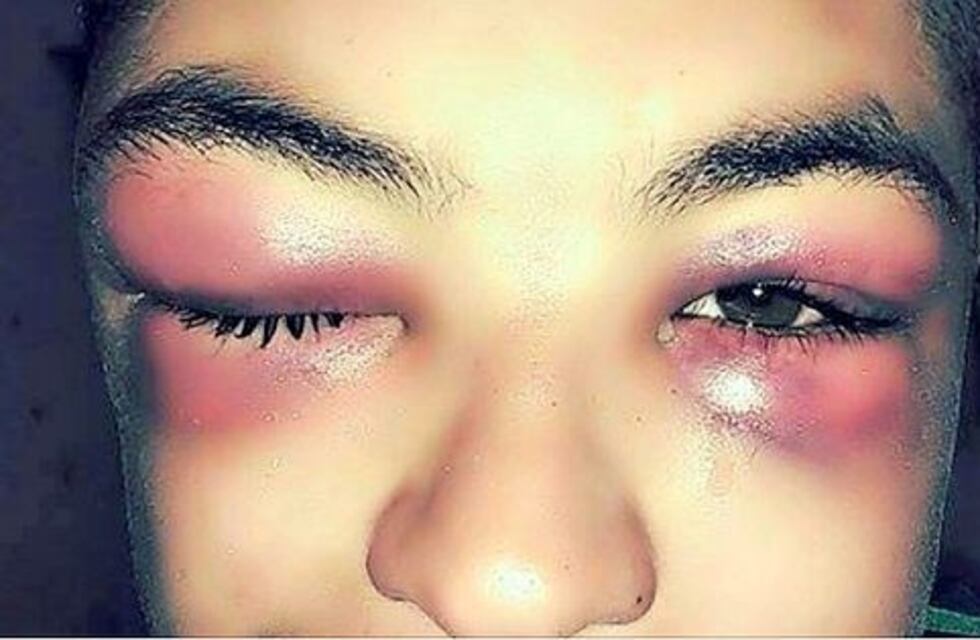 Oliva: detienen a dos policías acusados de desfigurar a un menor de 16 años