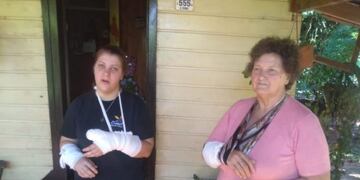 Dos mujeres fueron brutalmente atacadas por un pitbull\u002E (Foto: Misiones Online)