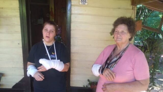 Dos mujeres fueron brutalmente atacadas por un pitbull\u002E (Foto: Misiones Online)