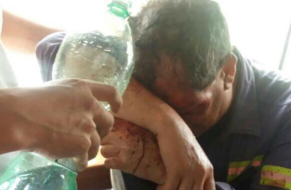 Dieron de alta al maquinista brutalmente golpeado en Malagueño