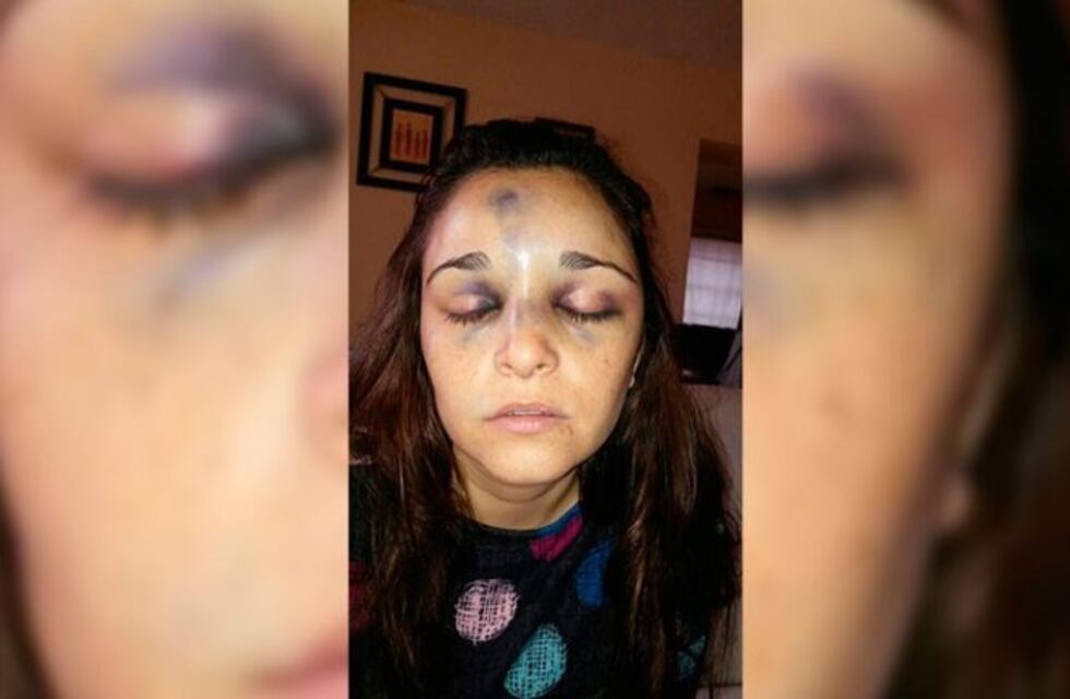 Una mujer de 31 años murió tras ser golpeada por su pareja, un chico de 17