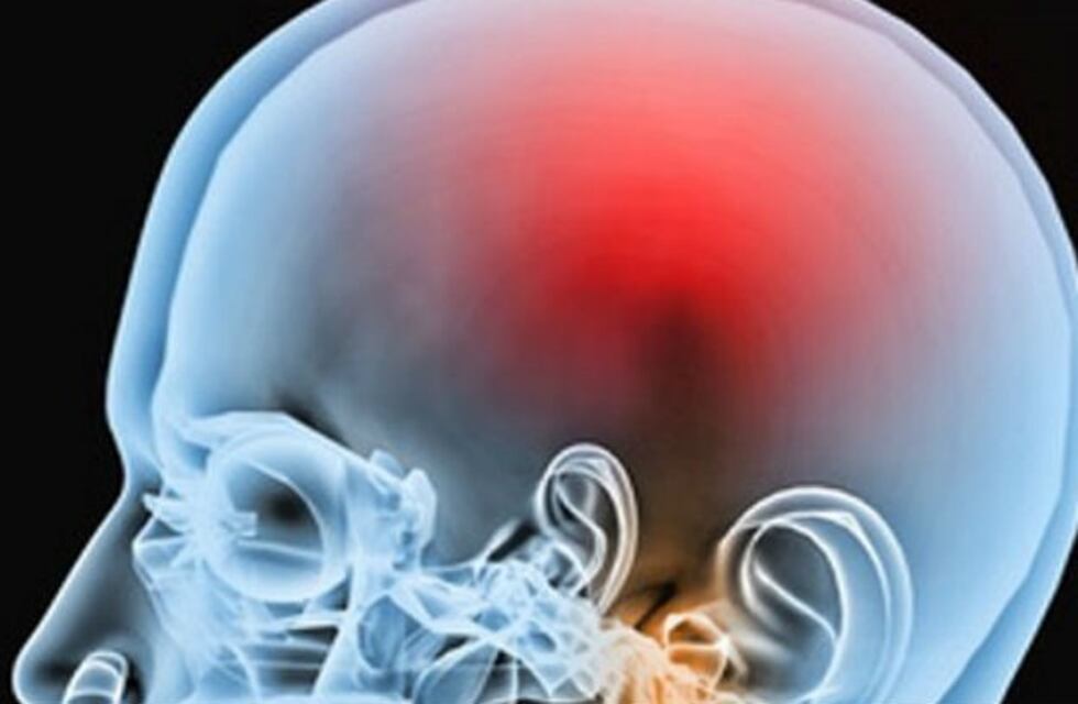 Traumatismo de cráneo: recuperar la calidad de vida es posible