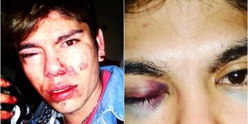 Entre Ríos: golpeó brutalmente a su compañero de escuela por ser homosexual