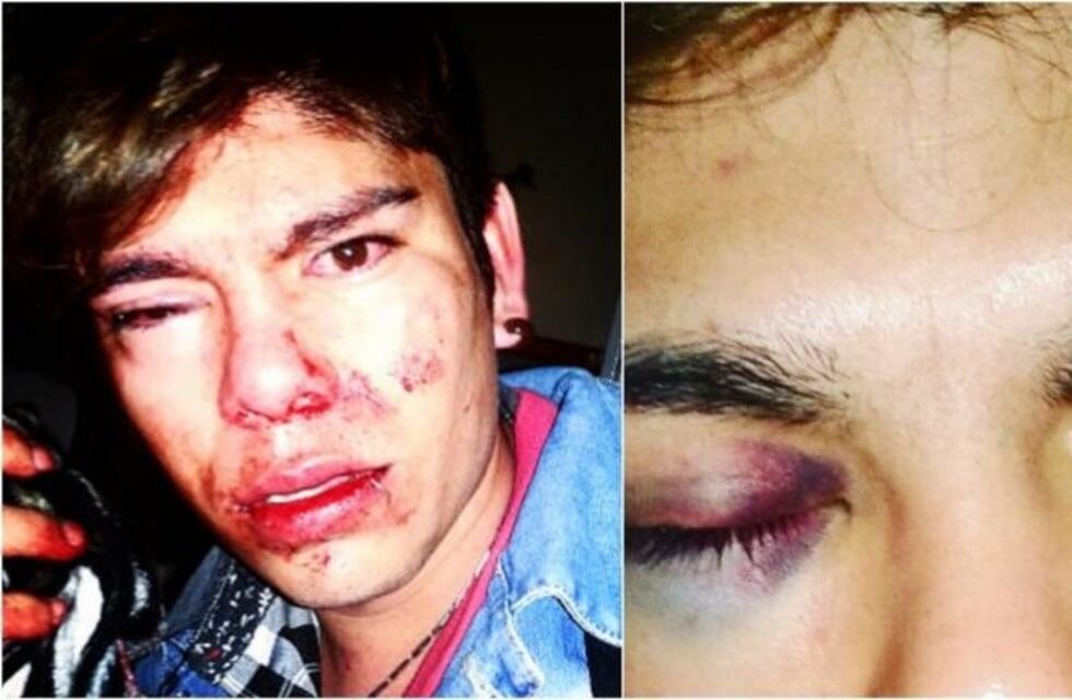 Entre Ríos: golpeó brutalmente a su compañero de escuela por ser homosexual
