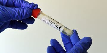 A health worker holds a test tube at a new coronavirus COVID-19 testing station for car travelers from the motorway at the motorway service area Hochfelln near Ruhpolding, southern Germany, on July 30, 2020\u002E (Photo by Christof STACHE / AFP)