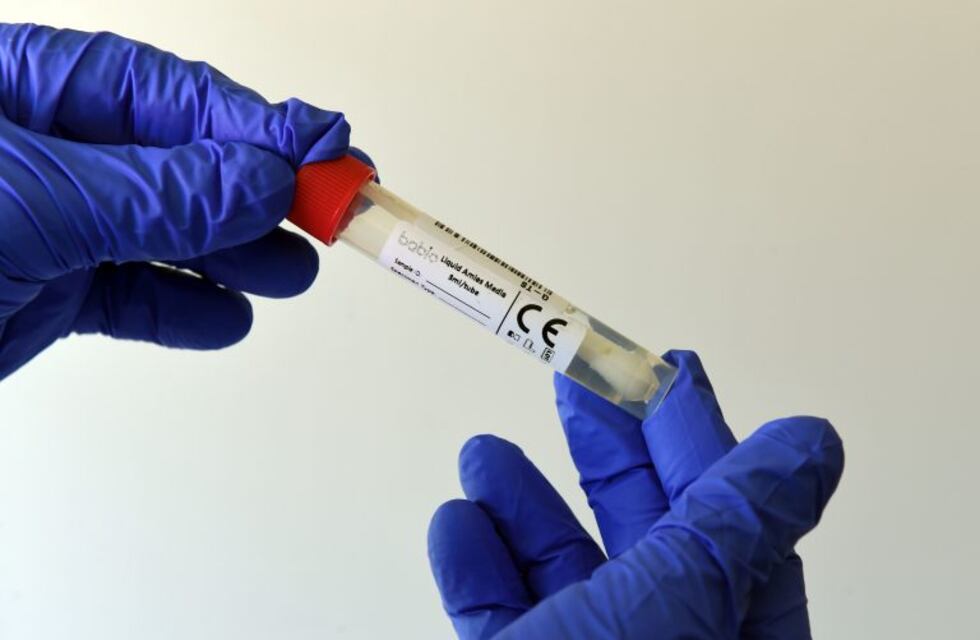 Coronavirus en Chaco: dos fallecidos y 84 nuevos casos confirmados
