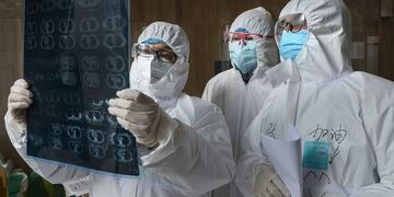 ¿Cómo afecta el coronavirus a nuestro cuerpo y cuáles son los grupos de riesgo?