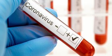 Coronavirus en Rafaela