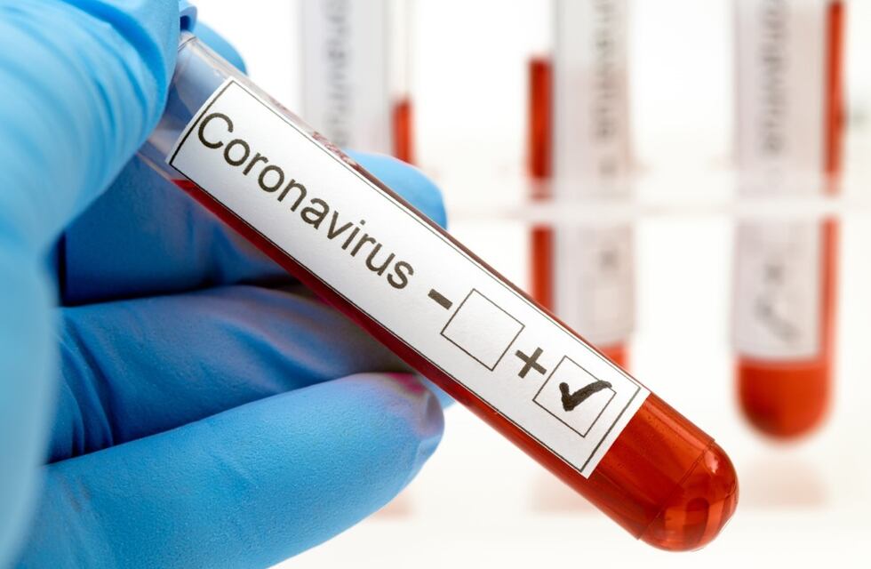 El departamento Castellanos, entre los distritos con “mayor riesgo epidemiológico” por coronavirus