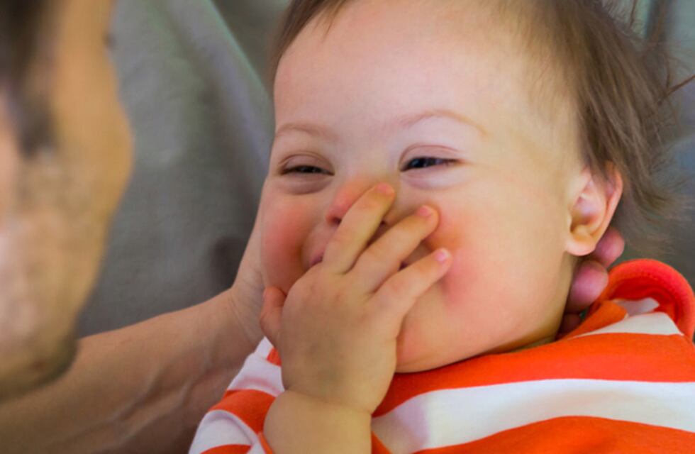 Tres Arroyos: en el Día Mundial del Síndrome de Down habrá actividades en el Parque Miedan