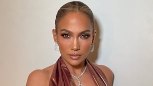 Jennifer Lopez mostró cómo quedó su cara tras un accidente.