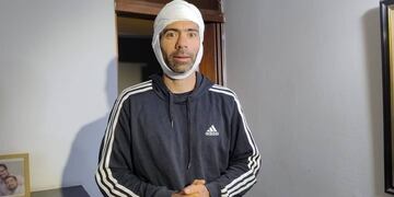 Una de las víctimas del robo piraña en la zona de Manantiales que recibió una tremenda paliza por parte de los ladrones.