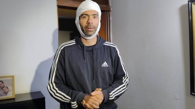 Una de las víctimas del robo piraña en la zona de Manantiales que recibió una tremenda paliza por parte de los ladrones.