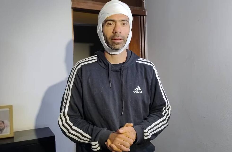 “Pelea de palos, piedras y cuchillo”: atacaron a un grupo de jóvenes mientras entrenaban en Córdoba