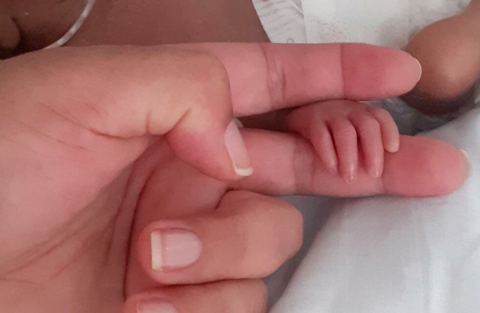 Todos por Bastian: nació prematuro y debe ser operado del corazón