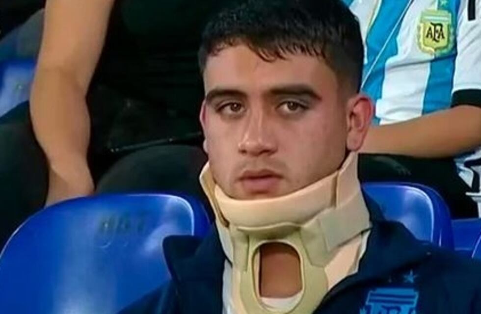 Buonanotte fue dado de alta y estuvo como espectador en el partido contra Brasil