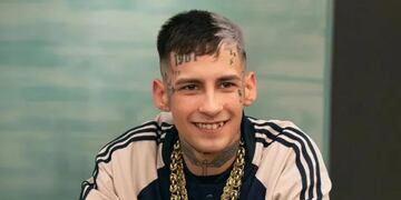 “El diagnóstico está mal”: El radical cambio estético que se realizó L-Gante en Colombia y generó rechazo