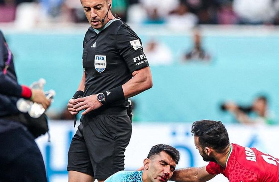 Mundial de Qatar 2022: el durísimo golpe que dejó al arquero iraní fuera del partido ante Inglaterra