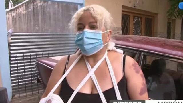 Una de las víctima del pitbull en Morón. (Captura)